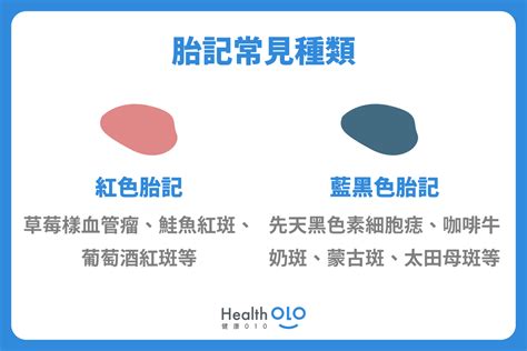 黑胎記|胎記怎麼產生、何時消除？醫師剖析胎記種類、胎記寓意